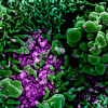 COVID19 colorized CDC NIH image