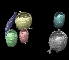 Machinelearning CryoET Figure Reduced Size