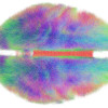 Color rendering of a map of neural connections in the brain