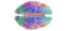 Color rendering of a map of neural connections in the brain